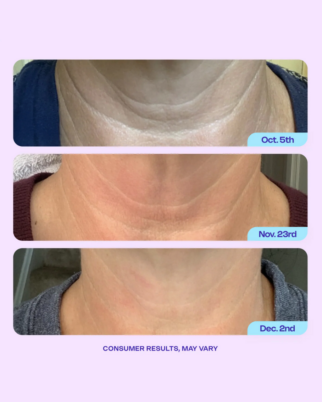 CASSIDY Tighten & Neck lift Cream 50gm