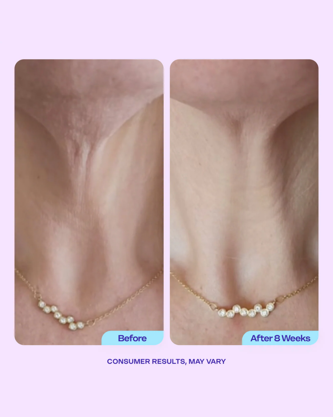 CASSIDY Tighten & Neck lift Cream 50gm