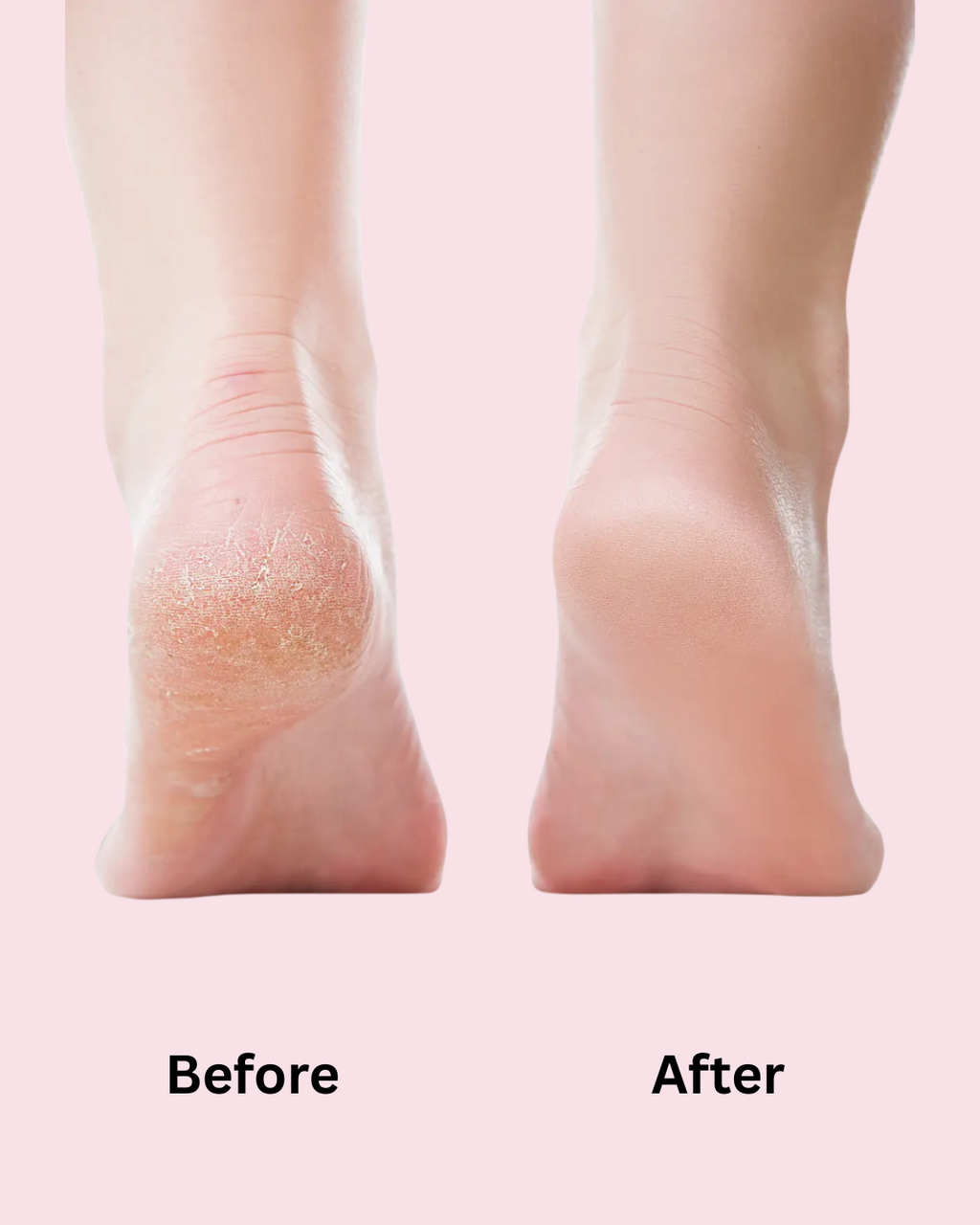 VelvetSole Pro™