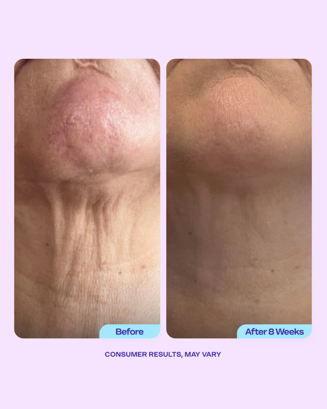 CASSIDY Tighten & Neck lift Cream 50gm