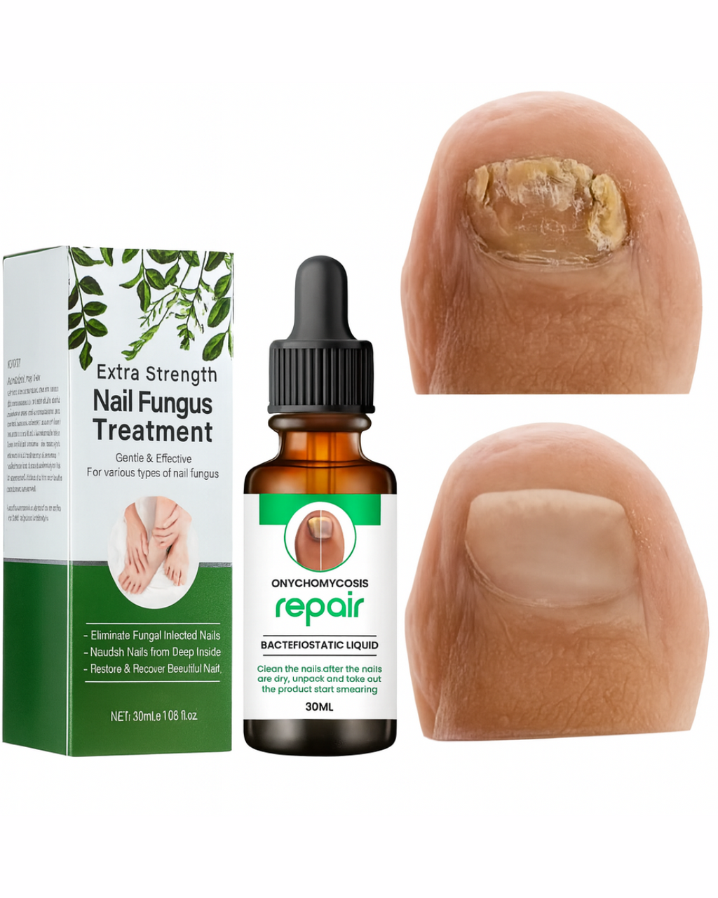 Nail Serum for long, healthy & fungus free nails