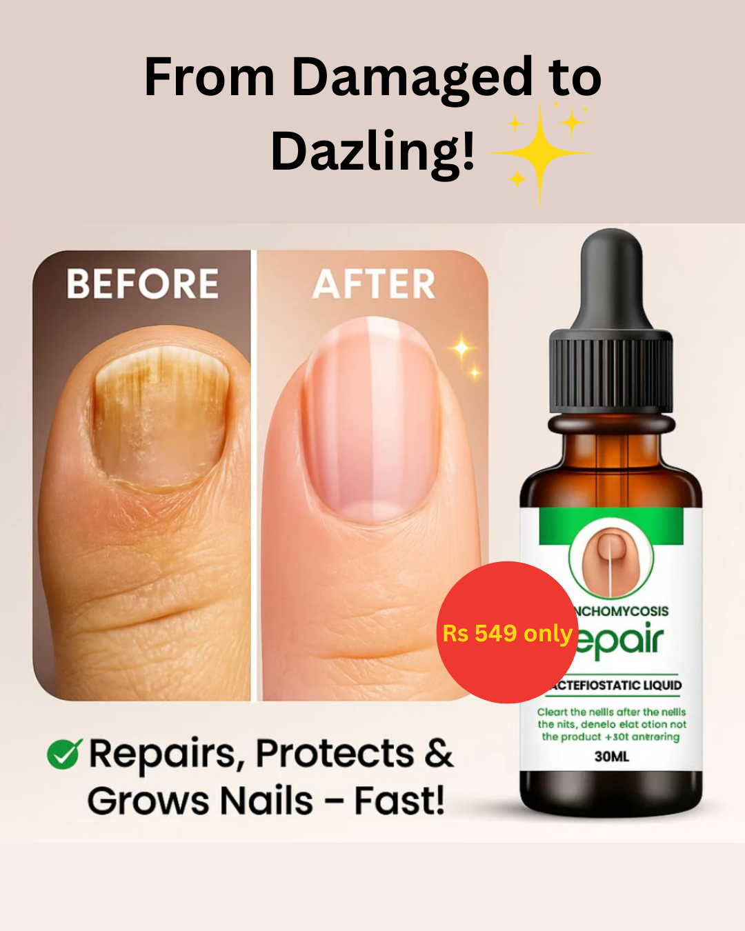 Nail Serum for long, healthy & fungus free nails